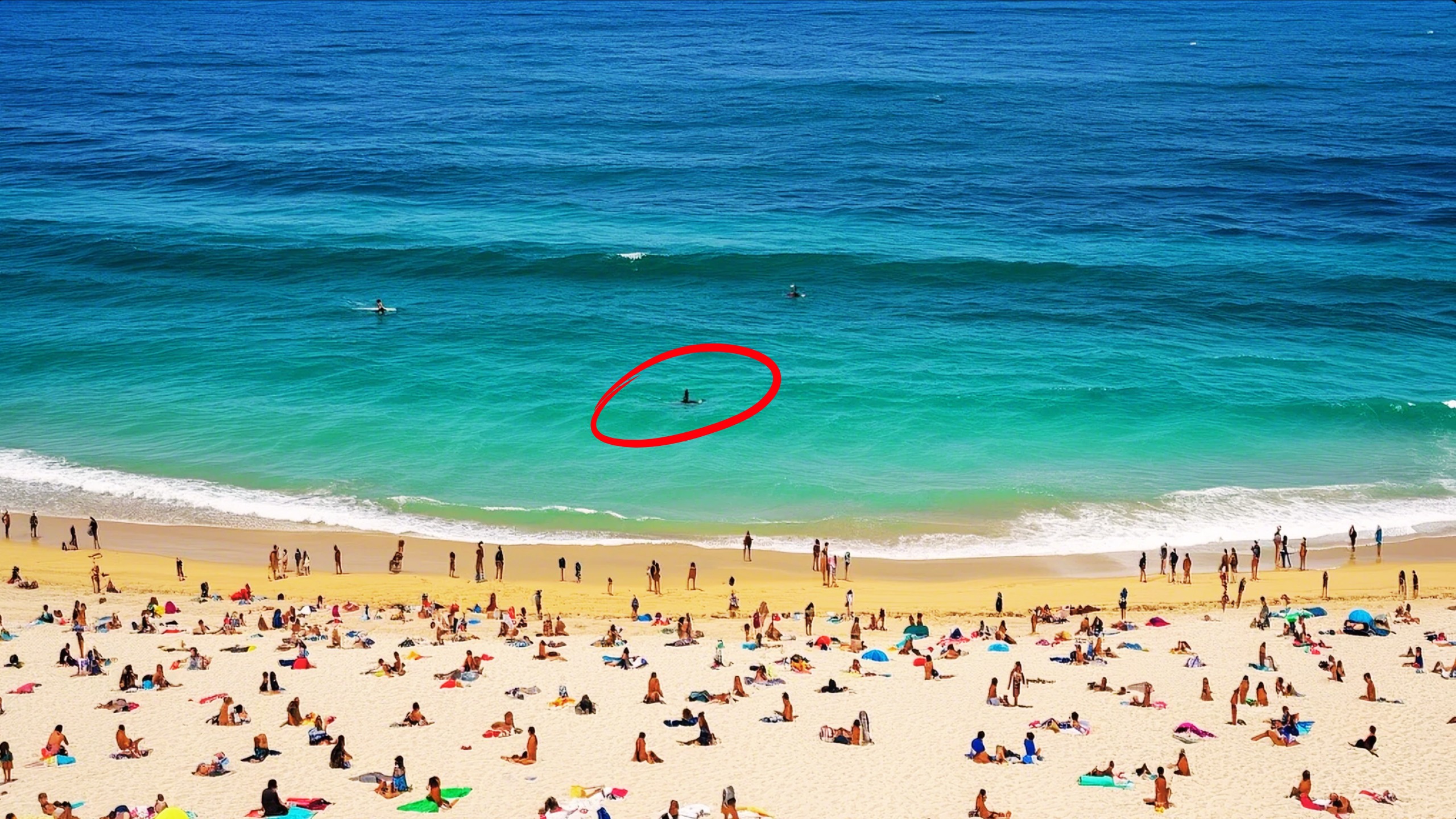 Surfista atacado na praia do litoral do rio de janeiro por tubarão revela milagre de nossa senhora